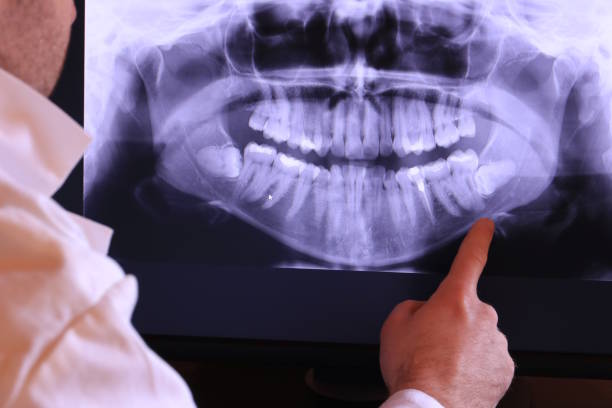 Best Knocked-Out Tooth Emergency  in Sunbury, OH